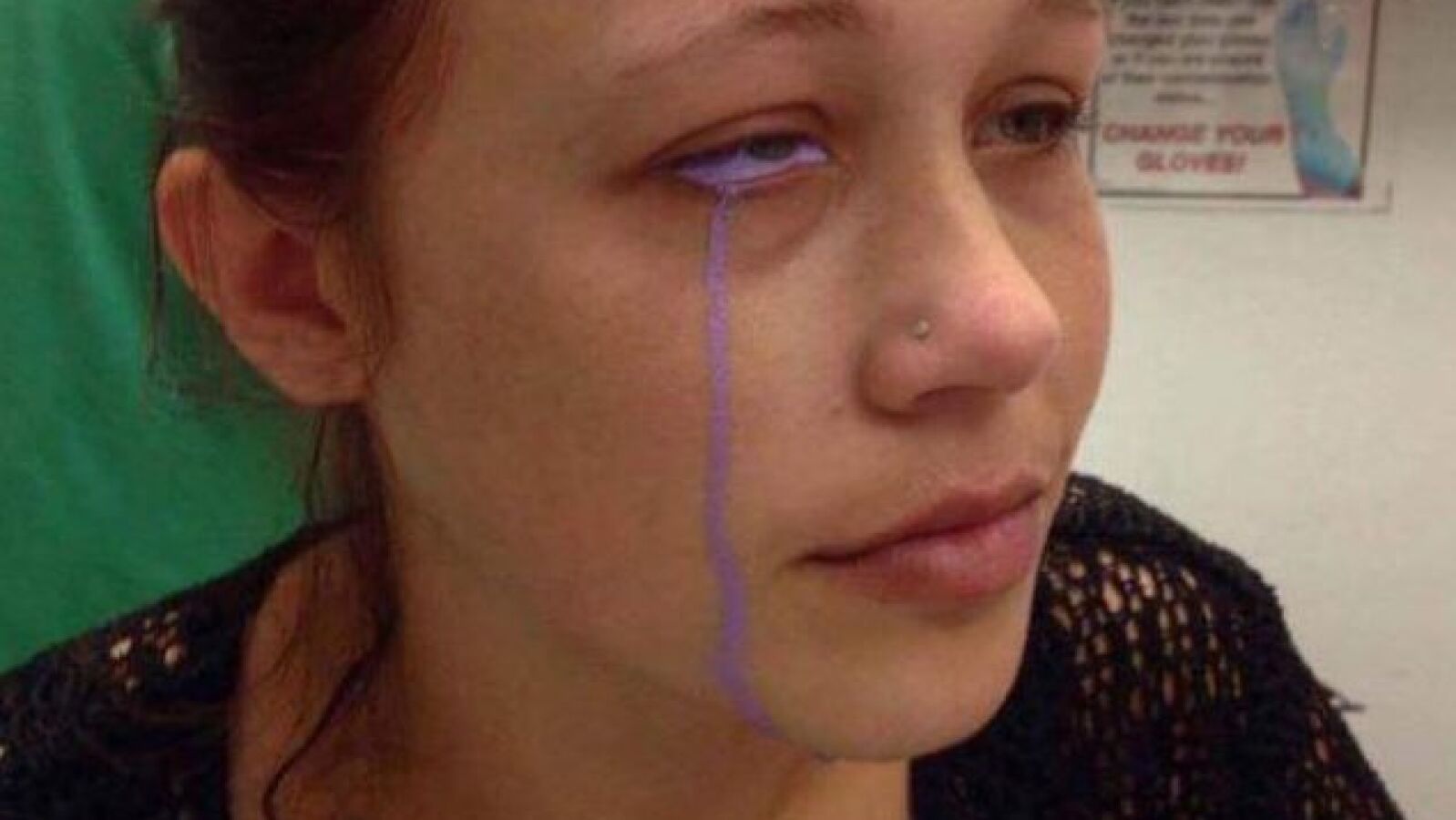 Una modelo canadiense se tatúa el ojo color purpura pero las cosas no salen nada bien