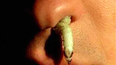 El gusano en la nariz y otras campañas antidroga eficaces pero que traumatizaron a los niños españoles