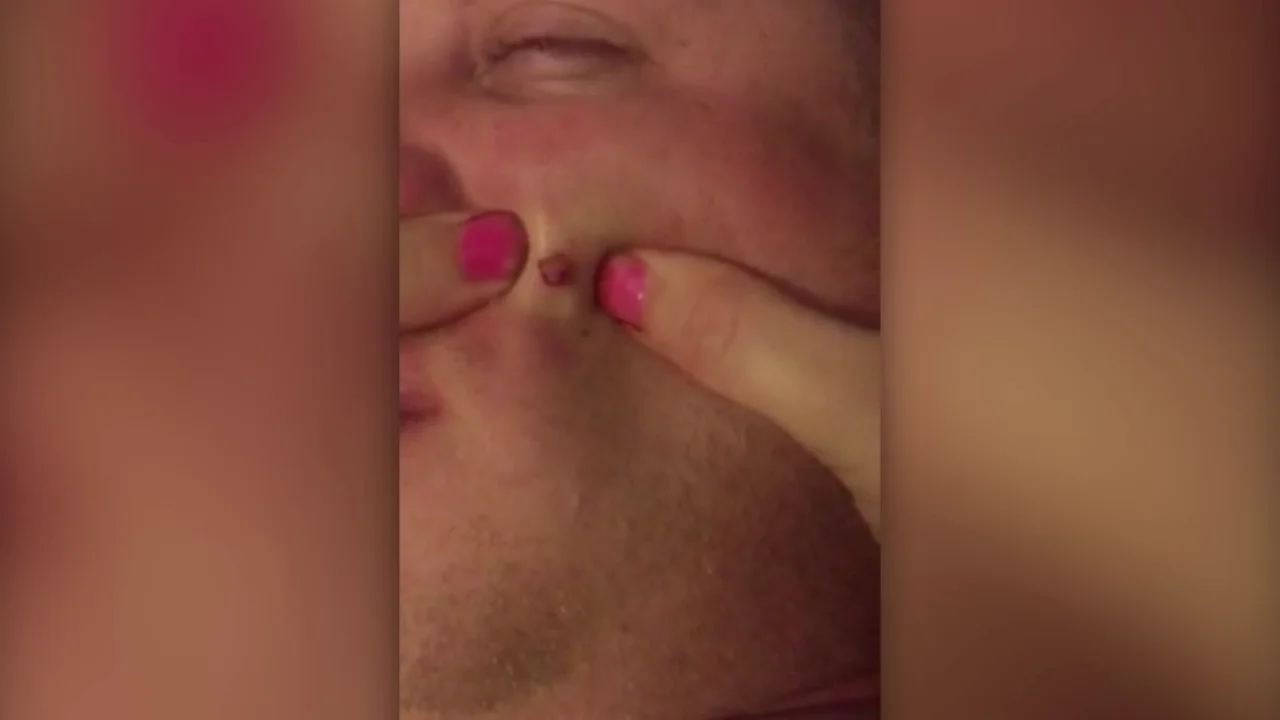 Mujer explota grano