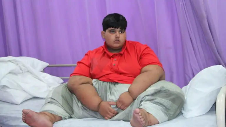Mohammed Abrar, el niño más gordo del mundo