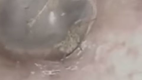 La araña en el conducto auditivo del señor