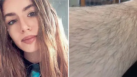 Instagramer no se depila las piernas Instagramer no se depila las piernas