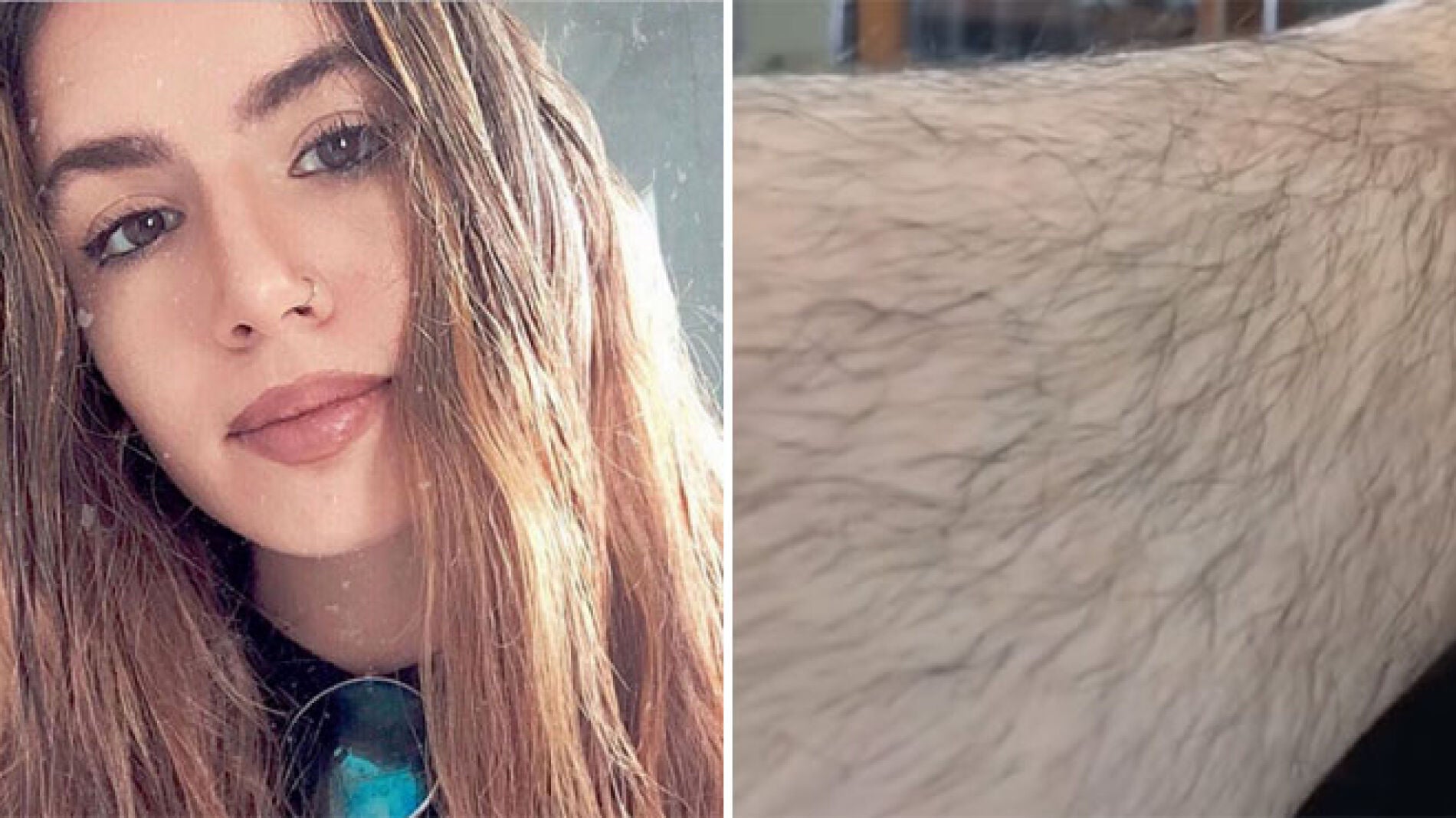 Instagramer no se depila las piernas