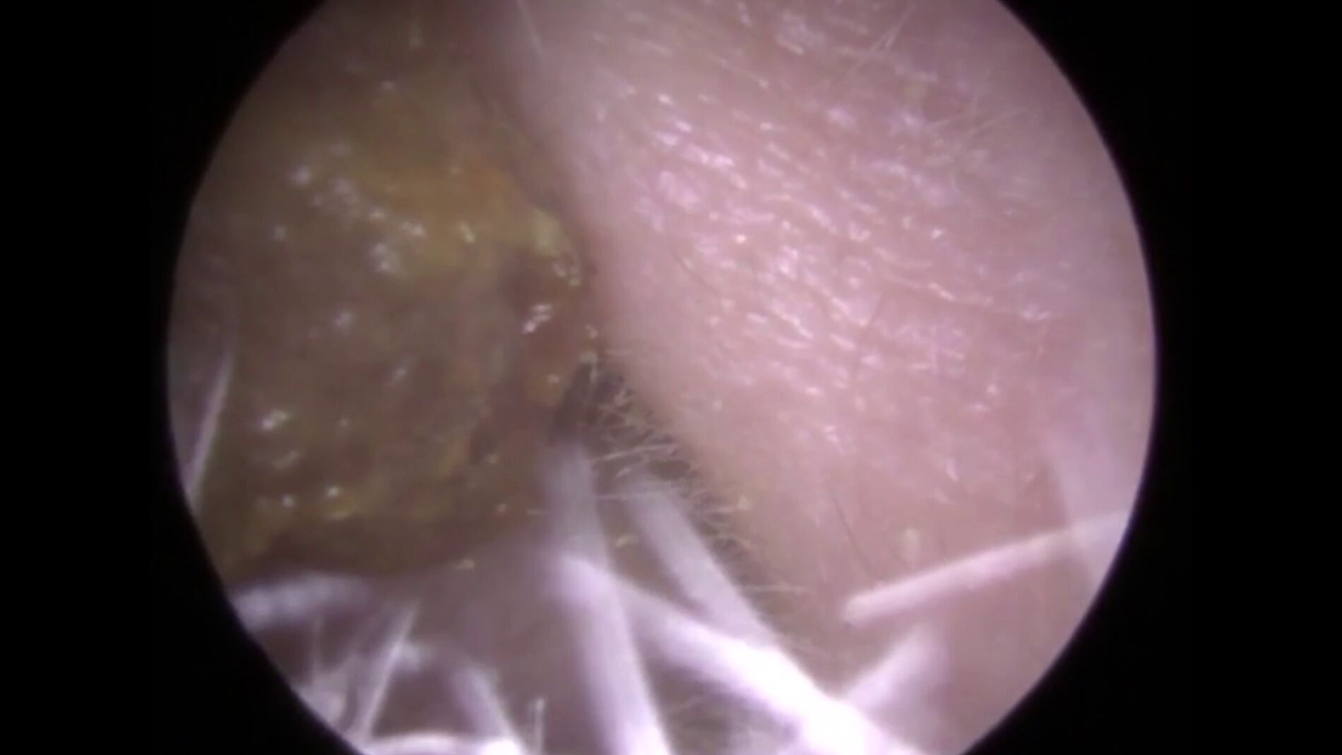 Tap&oacute;n de cera