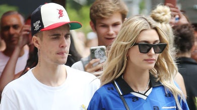 Justin Bieber se sincera sobre sus problemas con el acné y culpa a los filtros de Instagram 