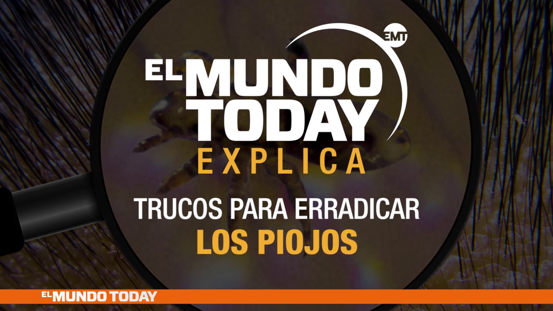 Trucos para erradicar los piojos