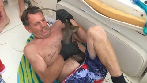 Mordisco de tiburón en la tripa Mordisco de tiburón en la tripa