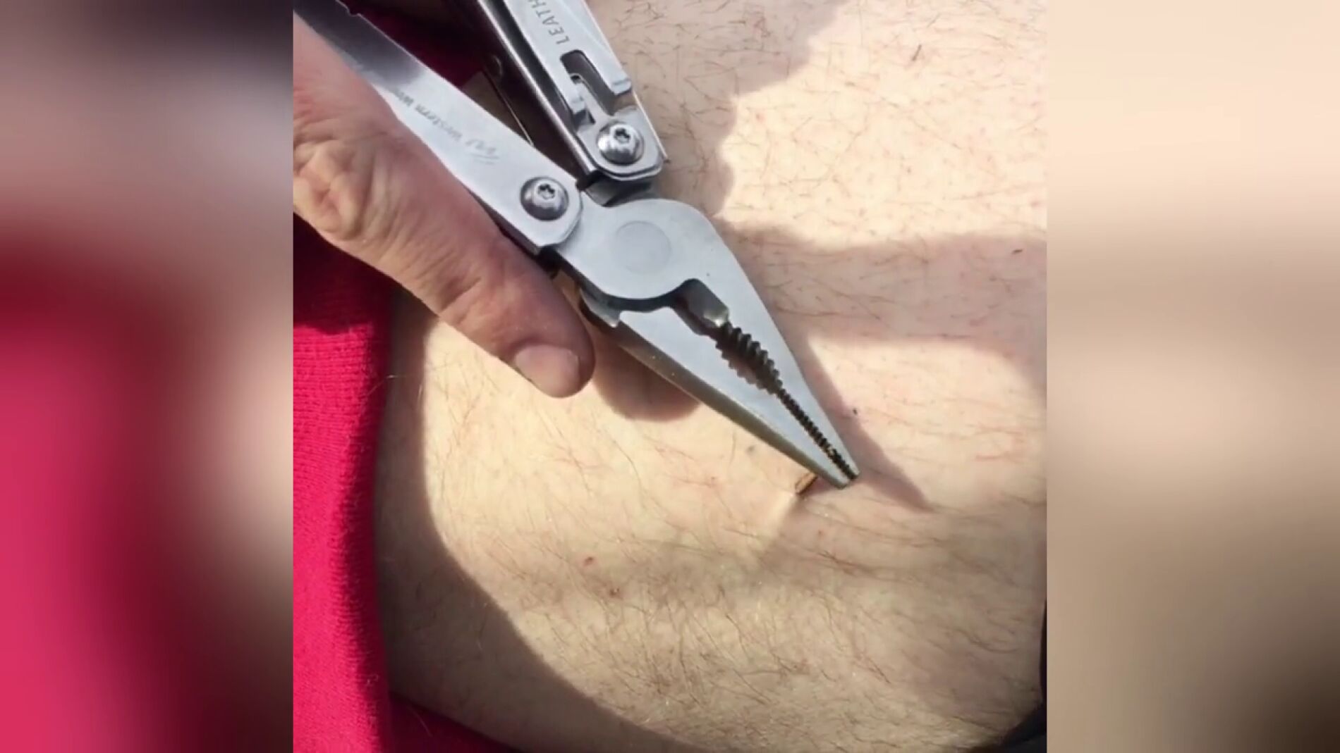 Una astilla en la pierna