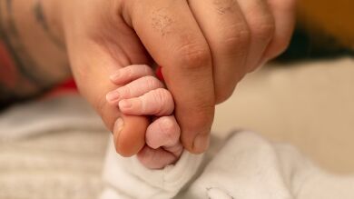 La adorable bebé que nació con unas manos del tamaño de una moneda 