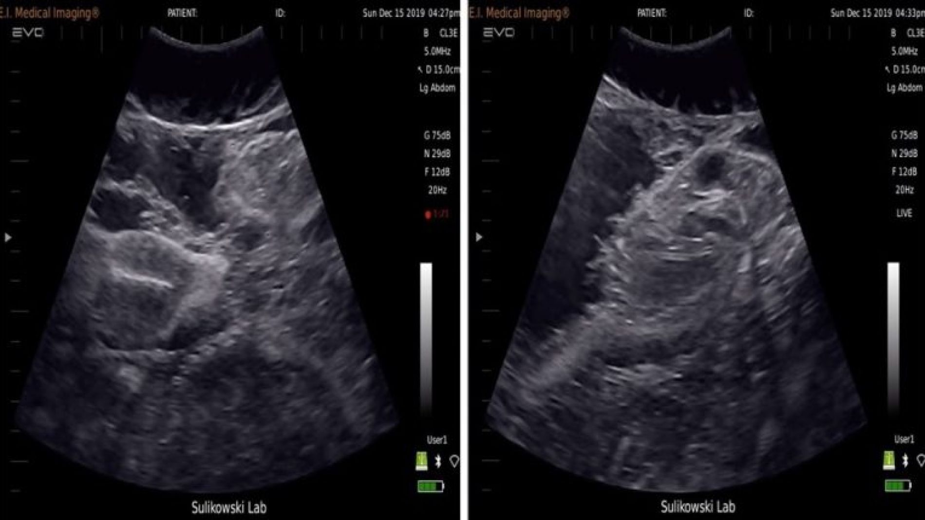 Ecograf&iacute;a de un feto de tibur&oacute;n