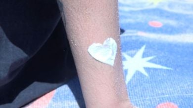 Las consecuencias de los tatuajes solares en verano