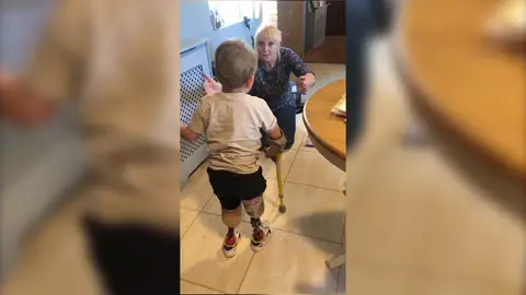 Mágico momento en el que un niño camina por primera vez desde que perdió las piernas Mágico momento en el que un niño camina por primera vez desde que perdió las piernas