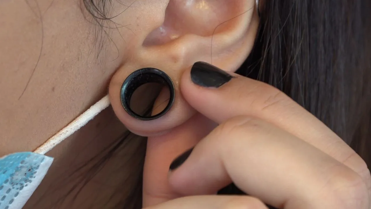 Dilatación en una oreja