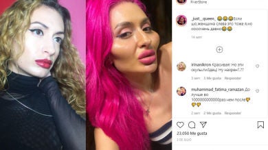 La mujer con las mejillas más grandes del mundo arrasa en Instagram y no vas a creer que es real cuando veas las fotos