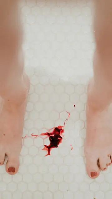 Hemos asumido que el dolor es una parte de la menstruación Hemos asumido que el dolor es una parte de la menstruación