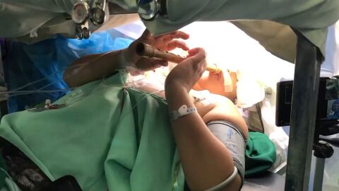 “Era como si estuvieran jugando en mi cabeza”. El impactante vídeo de una operación cerebral mientras la paciente toca la flauta