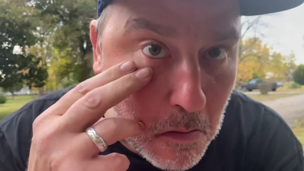 Un mago se come un caramelo y consigue sacarlo por el ojo