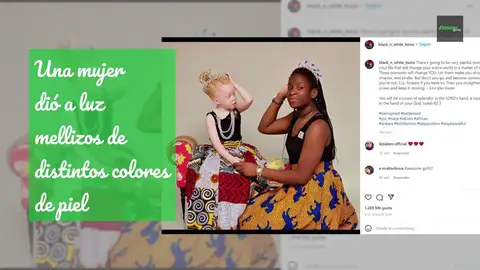 Una mujer dio a luz a mellizos con distinto color de piel y su reacción ha inundado las redes de comentarios Una mujer dio a luz a mellizos con distinto color de piel y su reacción ha inundado las redes de comentarios