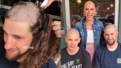 Familiares de esta famosa tiktoker con alopecia se dejaron crecer el pelo para regalarle una peluca