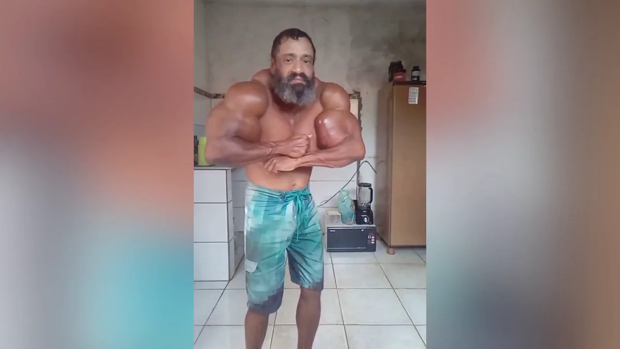 Fallece Valdir Segato, el &ldquo;Hulk brasile&ntilde;o&rdquo; que se inyectaba aceite en los brazos a los 55 a&ntilde;os