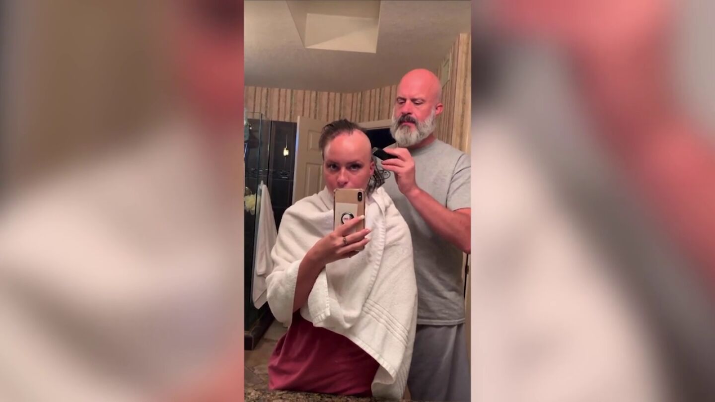 Una chica que fue acosada por tener alopecia triunfa en TikTok con m&aacute;s de un mill&oacute;n de seguidores