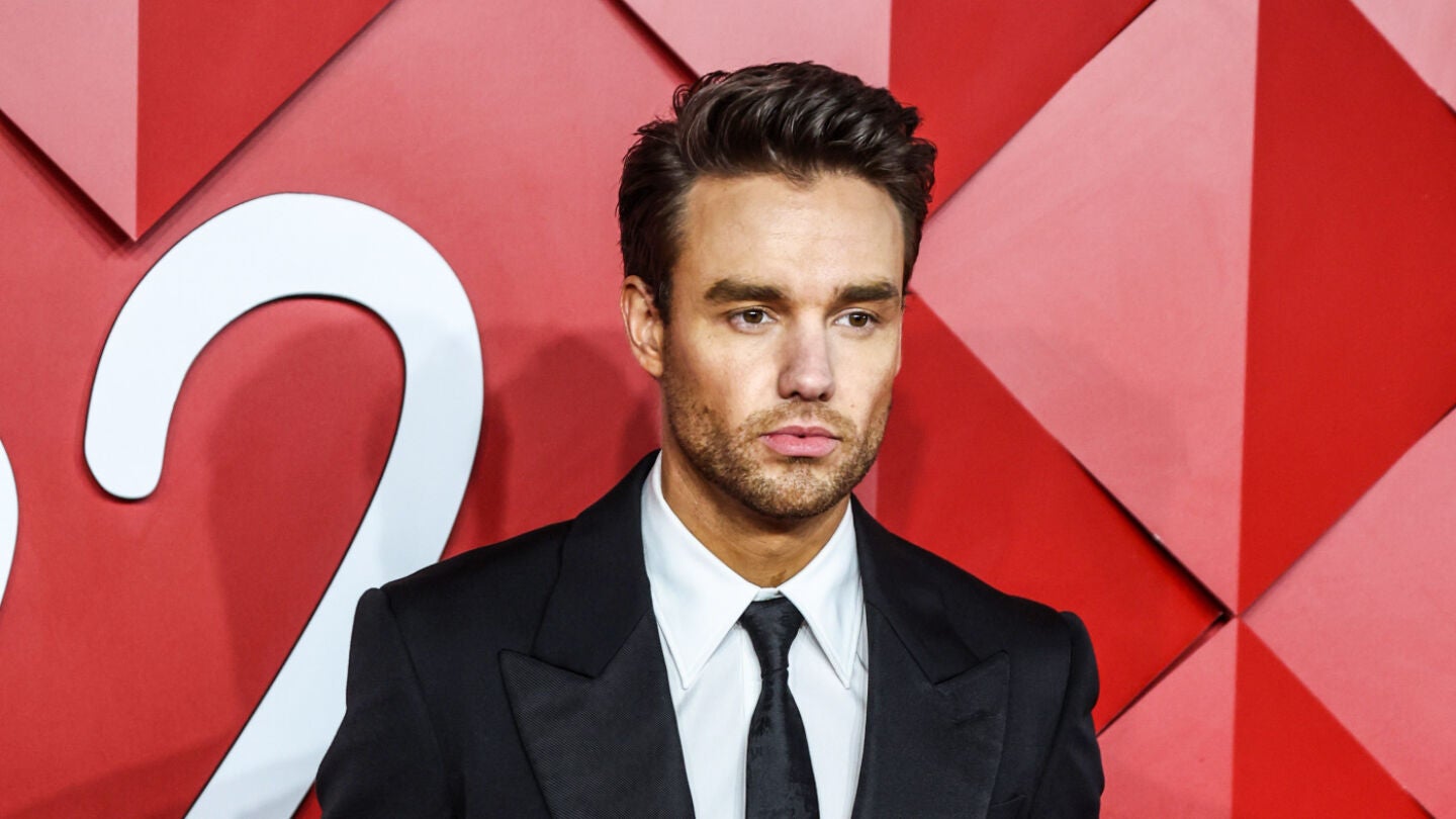 Liam Payne, antes de sus nuevos retoques.