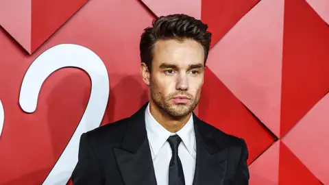 Liam Payne, antes de sus nuevos retoques. Liam Payne, antes de sus nuevos retoques.