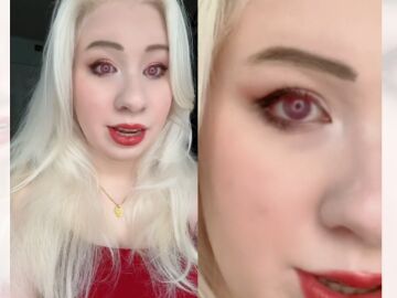Kayla en el TikTok viral sobre la pigmentación de su ojo