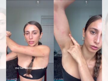 TikTok de Mar&iacute;a P&eacute;rez sobre las chinches.