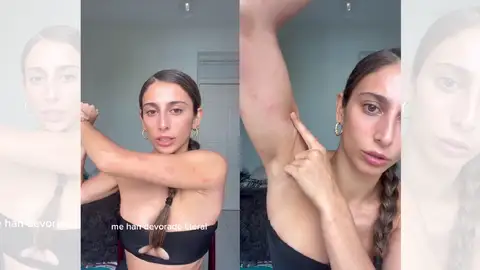 TikTok de María Pérez sobre las chinches. TikTok de María Pérez sobre las chinches.