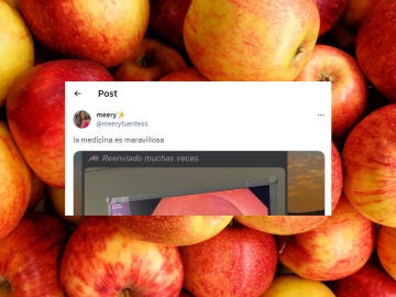 Le hicieron una colonoscopia y encontraron la pegatina de una manzana pegada