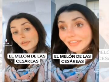 TikTok viral de una doctora que habla sobre la falta de bajas m&eacute;dicas por ces&aacute;rea.