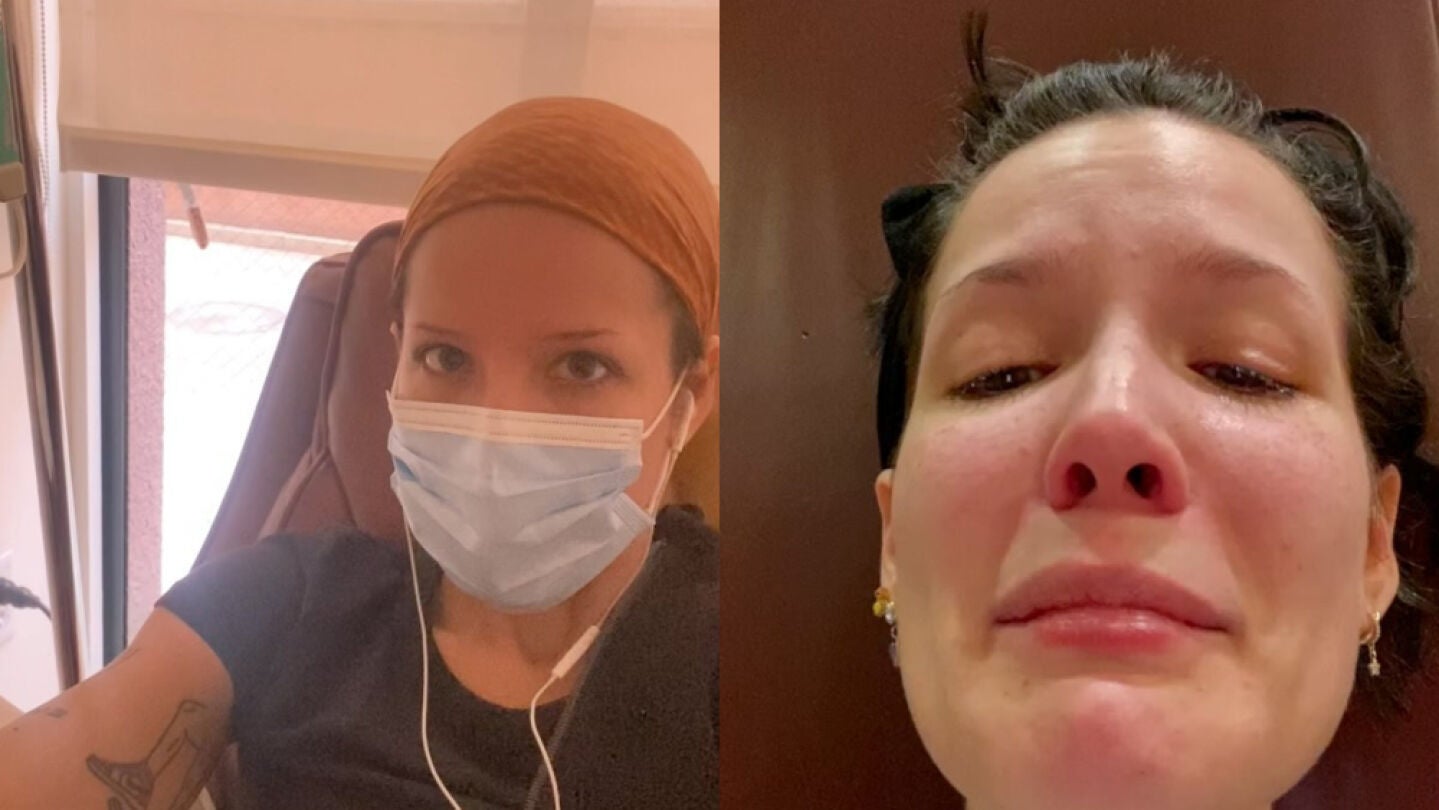 La popular cantante americana Halsey ha revelado que padece lupus y leucemia