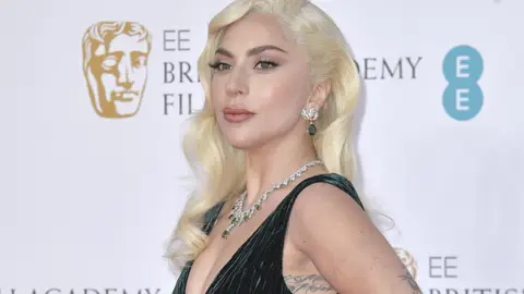 Lady Gaga. Lady Gaga.