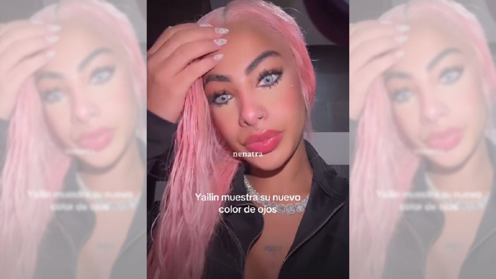 Yailin La más viral, sorprende con un cambio radical: cirugía para aclarar sus ojos