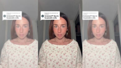 Esta es la reflexión viral de una tiktoker sobre los retoques estéticos: 