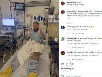 Jake Paul y su operaci&oacute;n de mand&iacute;bula.