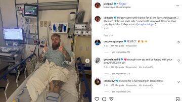 Jake Paul y su operaci&oacute;n de mand&iacute;bula.