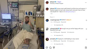 Jake Paul y su operación de mandíbula. Jake Paul y su operación de mandíbula.